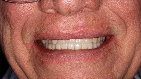 Healthy white smile after cosmetic dentistry