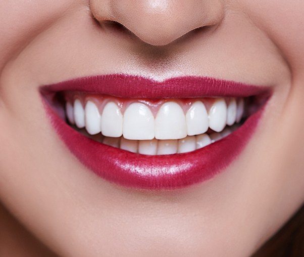 Woman's smile after gum recontouring treatment
