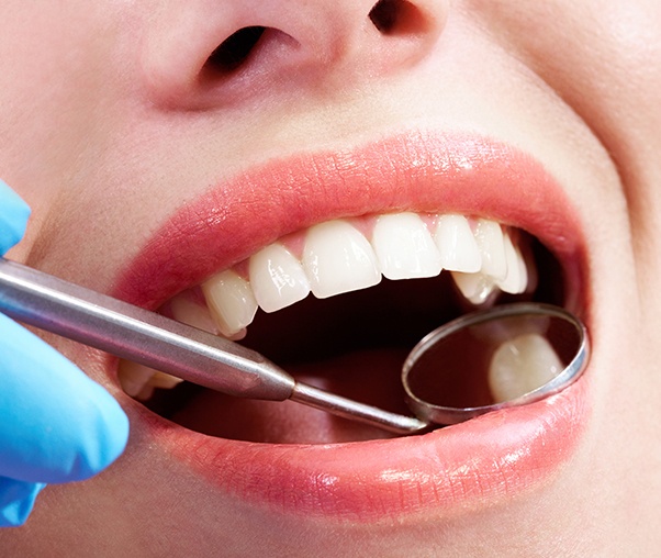 Dentist examining patient's smile after tooth colored filling placemen