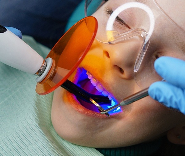 Child receiving dental sealants