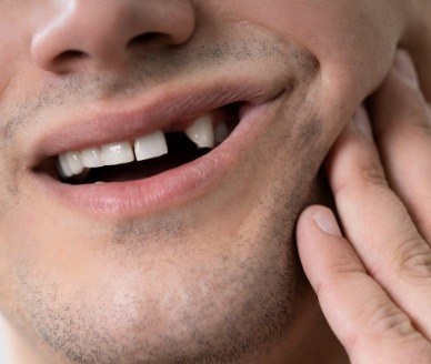 Smile with missing top tooth