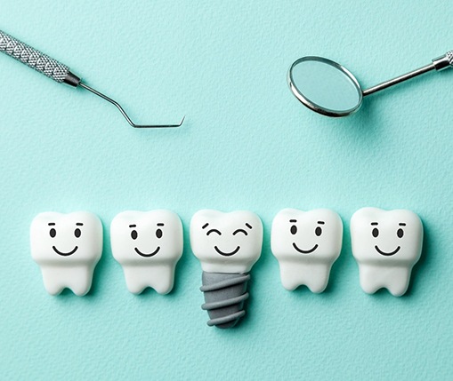 Illustration of dental implant in Carrollton