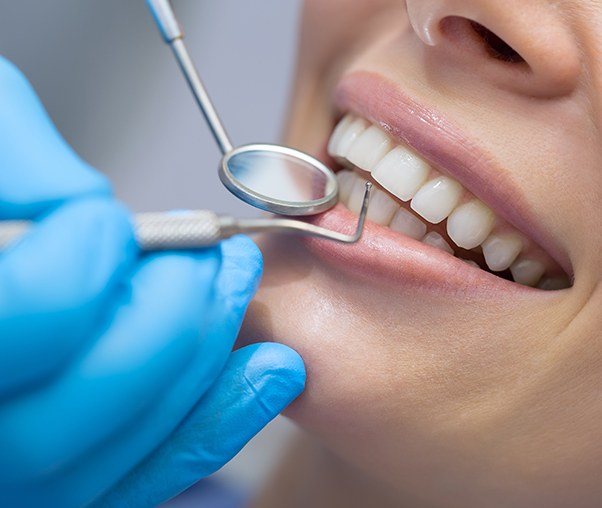 Closeup of patient receiving scaling and root planing periodontal therapy