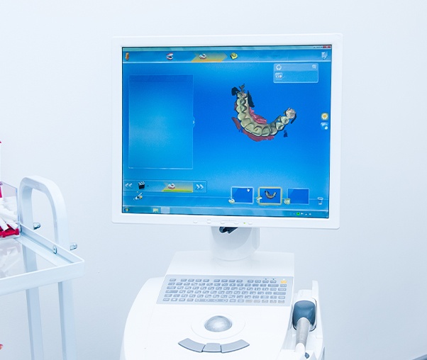 CEREC one visit dental restoration digital impression system