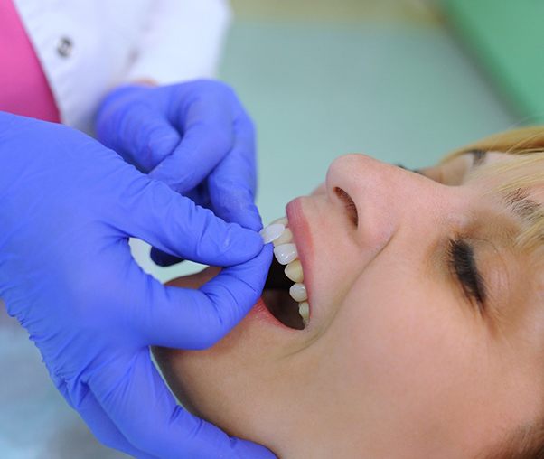 Dentist placing veneer against patient's tooth