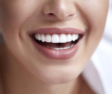 Closeup of beautiful smile with veneers in Carrollton