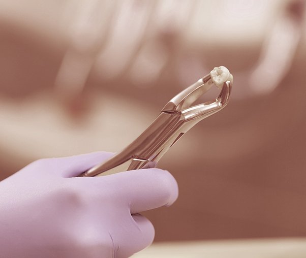 Dentist holding a tooth with dental forceps