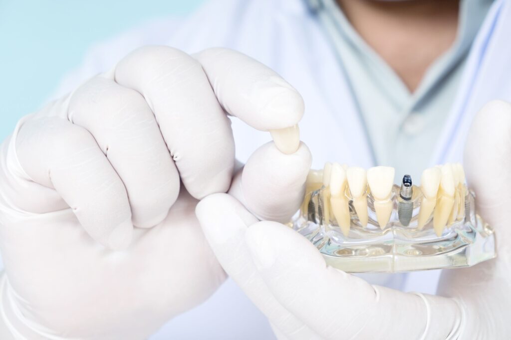 Dentist in white coat and gloves holding sample dental implant and crown